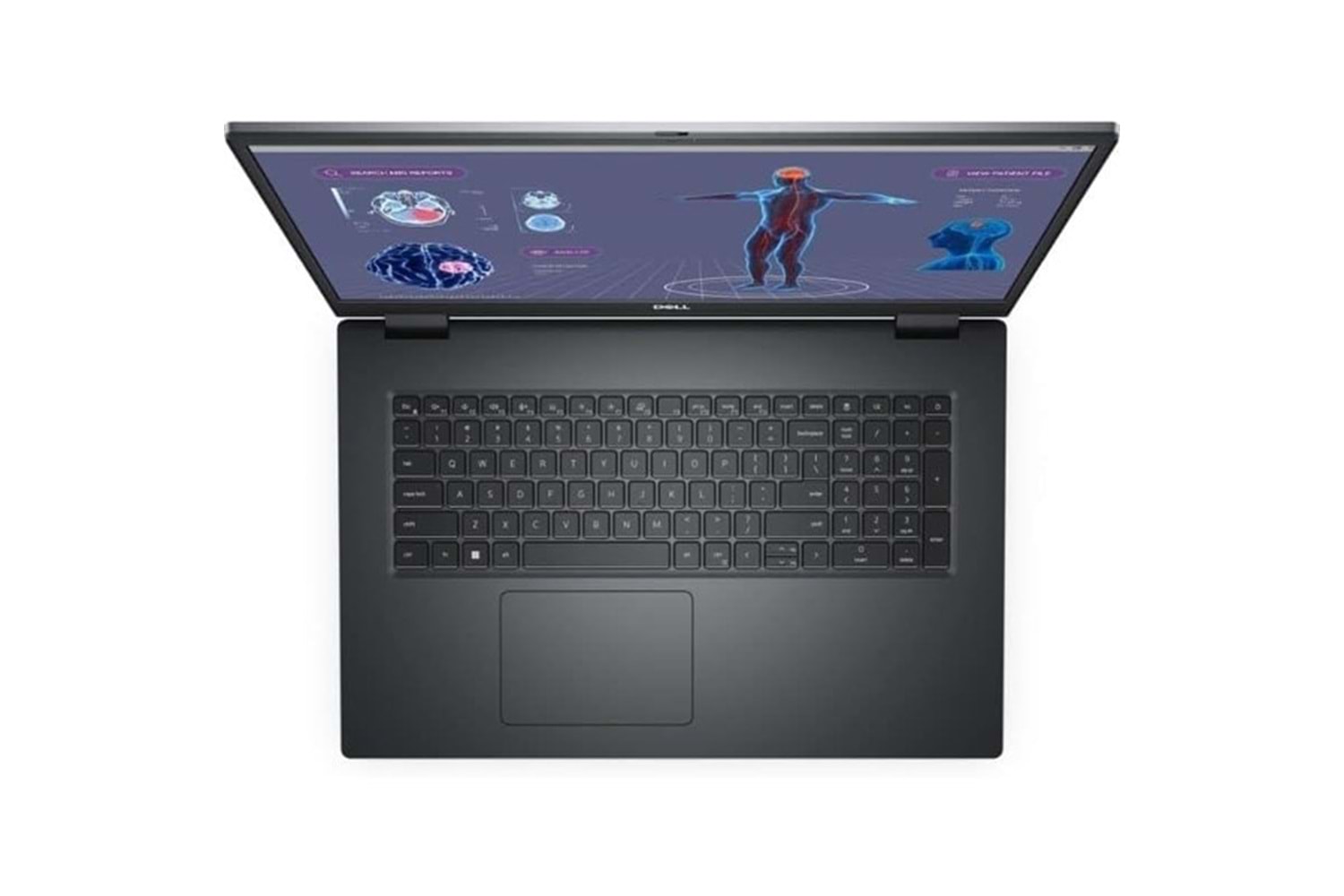 DELL 17.3